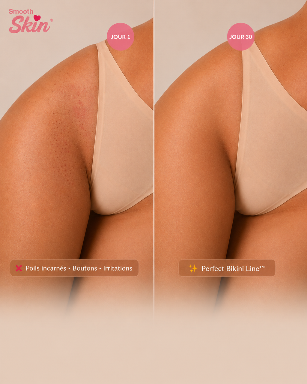 Perfect Bikini Line™ Roll-On