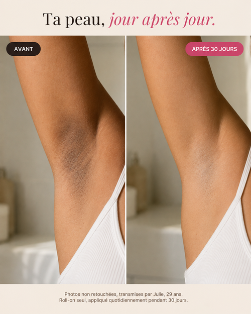 Perfect Bikini Line™ Roll-On